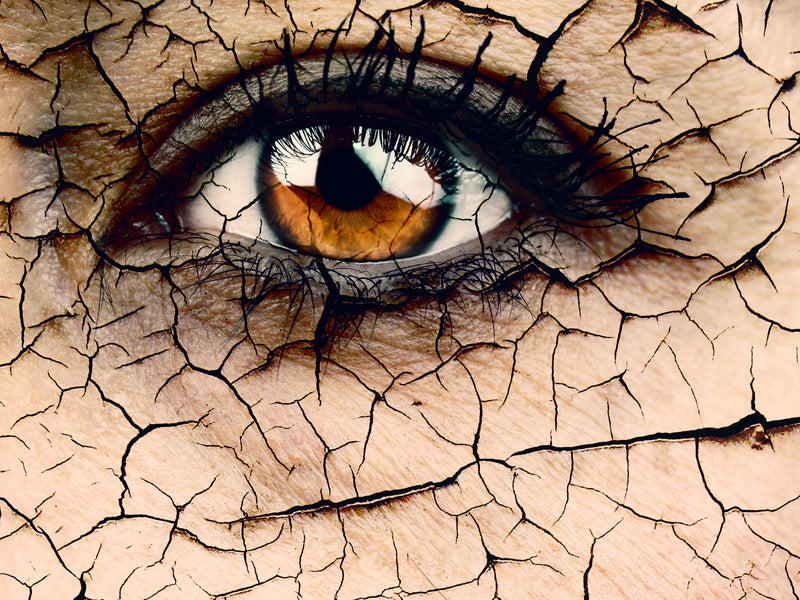 Tips to Prevent or Sooth Dry Eyes in winter